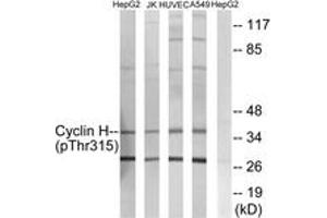 Western blot analysis of extracts from HepG2 cells, Jurkat cells, HuvEc cells and A549 cells, using Cyclin H (Phospho-Thr315) Antibody. (Cyclin H anticorps  (pThr315))