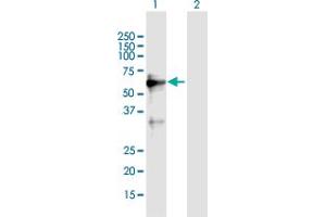 Western Blot analysis of ZNF554 expression in transfected 293T cell line by ZNF554 MaxPab polyclonal antibody. (ZNF554 anticorps  (AA 1-538))