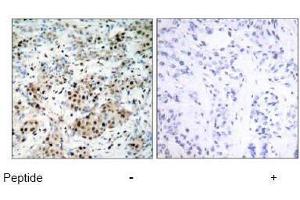 Image no. 1 for anti-cAMP Responsive Element Binding Protein 1 (CREB1) (Ser133) antibody (ABIN197188) (CREB1 anticorps  (Ser133))