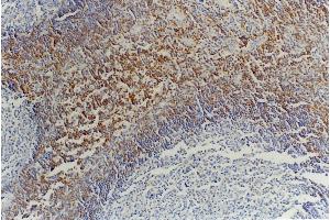 Immunohistochemistry staining of tonsil (paraffin-embedded sections) with anti-CD45RB (MEM-55).