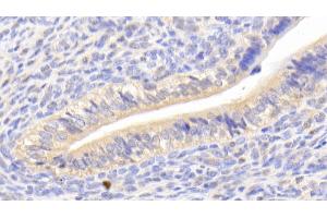 Detection of CA125 in Mouse Uterus Tissue using Polyclonal Antibody to Carbohydrate Antigen 125 (CA125) (MUC16 anticorps  (AA 2-258))