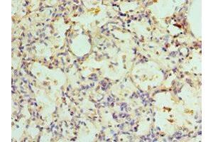 Immunohistochemistry of paraffin-embedded human lung tissue using ABIN7143352 at dilution of 1:100 (Adenylosuccinate Lyase anticorps  (AA 1-310))