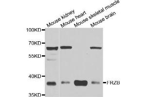 Western blot analysis of extracts of various cell lines, using FRZB antibody (ABIN5973961) at 1/1000 dilution. (FRZB anticorps)