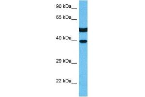 Host:  Mouse  Target Name:  MAPK14  Sample Tissue:  Mouse Kidney  Antibody Dilution:  1ug/ml (MAPK14 anticorps  (C-Term))