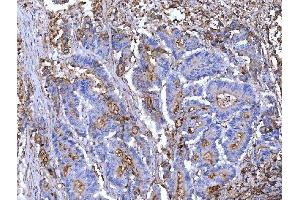 IHC analysis of CD55 using anti-CD55 antibody (ABIN7601422).