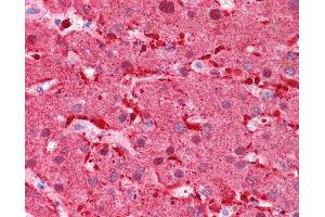 Immunohistochemistry (IHC) image for anti-Fatty Acid Binding Protein 1, Liver (FABP1) (N-Term) antibody (ABIN2782982) (FABP1 anticorps  (N-Term))