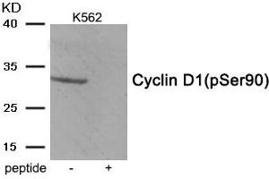 Western blot analysis of extracts from K562 tissue using Cyclin D1 (Phospho-Ser90) antibody. (Cyclin D1 anticorps  (pSer90))