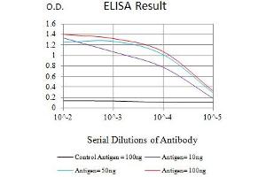 Black line: Control Antigen (100 ng),Purple line: Antigen (10 ng), Blue line: Antigen (50 ng), Red line:Antigen (100 ng) (IL4 Receptor anticorps  (AA 26-232))