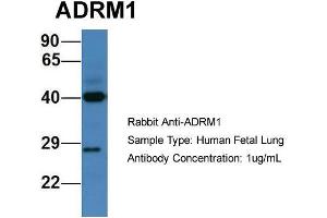 Host: Rabbit  Target Name: ADRM1  Sample Tissue: Human Fetal Lung  Antibody Dilution: 1. (ADRM1 anticorps  (C-Term))