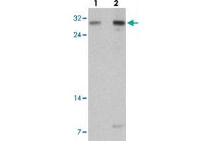 Western blot analysis of TLX2 in rat brain tissue with TLX2 polyclonal antibody  at (lane 1) 0.