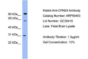 WB Suggested Anti-CPNE6  Antibody Titration: 0. (CPNE6 anticorps  (Middle Region))