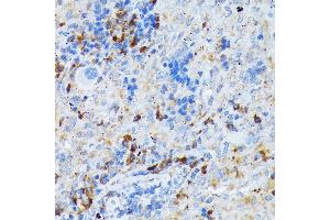 Immunohistochemistry of paraffin-embedded rat spleen using CD209 Rabbit mAb (ABIN7266173) at dilution of 1:100 (40x lens). (DC-SIGN/CD209 anticorps)
