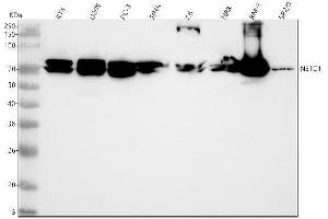 Western blot analysis of NETO1 using anti-NETO1 antibody (ABIN7601887).