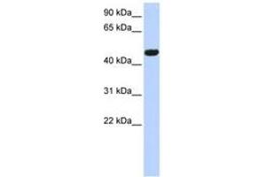 Image no. 1 for anti-Calcium Channel, Voltage-Dependent, beta 4 Subunit (CACNB4) (AA 250-300) antibody (ABIN6742717)