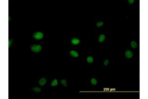 Immunofluorescence of monoclonal antibody to SGK2 on HeLa cell. (SGK2 anticorps  (AA 293-367))