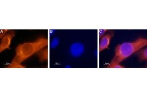 Expression of PAR-2 in human prostate carcinoma cell line - Immunocytochemical staining of paraformaldehyde-fixed and permeabilized human PC-3 cells.