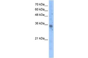 SLC25A16 antibody used at 5 ug/ml to detect target protein.