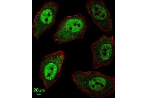 Immunofluorescent analysis of  cells, using EX2 Antibody (Center) 8975c.