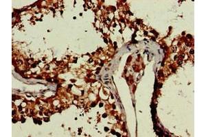 Immunohistochemistry of paraffin-embedded human testis tissue using ABIN7150470 at dilution of 1:100