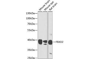 Western blot analysis of extracts of various cell lines, using FBXO2 antibody (ABIN6130381, ABIN6140514, ABIN6140515 and ABIN6224682) at 1:1000 dilution. (FBXO2 anticorps  (AA 1-296))