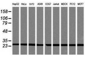 Image no. 2 for anti-Proteasome Subunit alpha 2 (PSMA2) (AA 50-234) antibody (ABIN1491568) (PSMA2 anticorps  (AA 50-234))