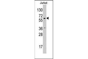 Western blot analysis using AP14221PU-N CYP19A1 antibody in Jurkat cell line lysates (35 µg/lane). (Aromatase anticorps  (C-Term))