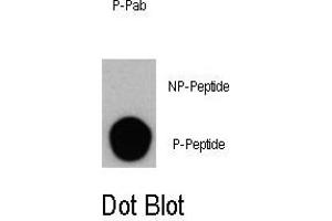 Dot blot analysis of Phospho-PI3KC3- Antibody (ABIN389784 and ABIN2839691) on nitrocellulose membrane. (PIK3C3 anticorps  (pSer164))