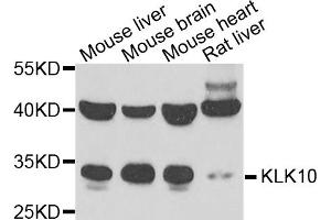 Western blot analysis of extracts of various cell lines, using KLK10 antibody (ABIN5973800) at 1/1000 dilution. (Kallikrein 10 anticorps)