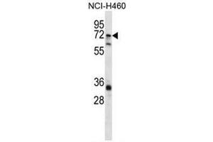 ST6GALNAC1 Antibody (N-term) western blot analysis in NCI-H460 cell line lysates (35µg/lane). (ST6GALNAC1 anticorps  (N-Term))