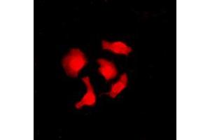 Immunofluorescent analysis of CABLES1 staining in SHSY5Y cells.