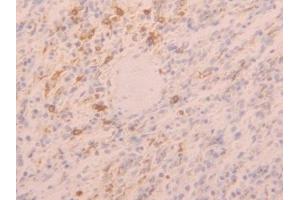 Detection of TLR5 in Human Spleen Tissue using Polyclonal Antibody to Toll Like Receptor 5 (TLR5)