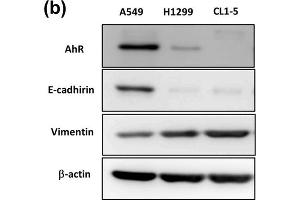 Aryl hydrocarbon receptor (AhR) expression in different cells was correlated with E-cadherin and vimentin expression and cell motility. (Vimentin anticorps)