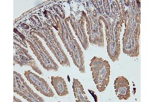 IHC analysis of DDR1 using anti-DDR1 antibody (ABIN7601407). (DDR1 anticorps  (AA 341-909))