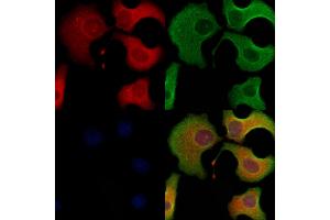 ABIN6263600 and ABIN6278494 staining Hela cells by IF/ICC. (Tetraspanin 9 anticorps  (Internal Region))