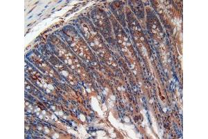 IHC-P analysis of Kidney tissue, with DAB staining. (ALT anticorps  (AA 720-961))
