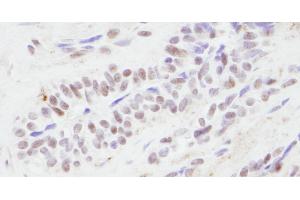 Immunohistochemistry (IHC) image for anti-CREB Binding Protein (CREBBP) (AA 2375-2425) antibody (ABIN7454618) (CBP anticorps  (AA 2375-2425))