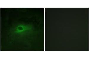 Immunofluorescence analysis of HeLa cells, using CSFR (Ab-809) Antibody.