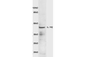 Mouse lung lysates probed with Anti-IL-1R2 Polyclonal Antibody  at 1:5000 90min in 37˚C. (IL1R2 anticorps  (AA 301-398))