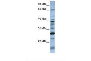 Image no. 1 for anti-Dolichyl Pyrophosphate Phosphatase 1 (DOLPP1) (N-Term) antibody (ABIN6738570) (DOLPP1 anticorps  (N-Term))