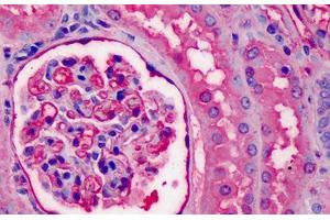 Human Kidney: Formalin-Fixed, Paraffin-Embedded (FFPE)