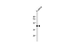 Anti-WNT7A Antibody at 1:2000 dilution + human uterus lysates Lysates/proteins at 20 μg per lane.