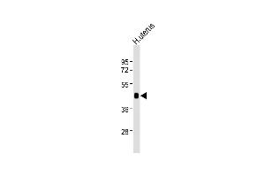 Anti-WNT7A Antibody at 1:2000 dilution + human uterus lysates Lysates/proteins at 20 μg per lane. (WNT7A anticorps)