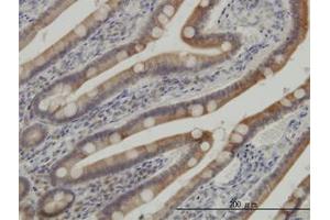 Image no. 1 for anti-Casein Kinase 1, gamma 1 (CSNK1G1) (AA 293-393) antibody (ABIN599257) (CSNK1G1 anticorps  (AA 293-393))