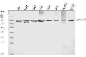 anti-Prothrombin Fragment 2 (AA 97-124) antibody