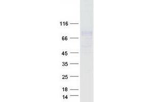 Validation with Western Blot