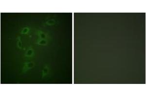 Immunofluorescence analysis of HepG2 cells, using CBL (Phospho-Tyr700) Antibody. (CBL anticorps  (pTyr700))