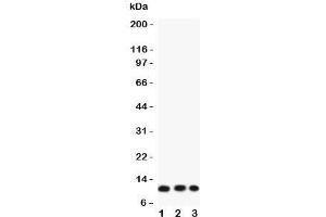 Western blot testing of Eotaxin 3 antibody and Lane 1:  COLO320;  2: A549;  3: HT1080 lysate.