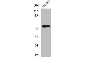 Western Blot analysis of COLO205 cells using XPLN Polyclonal Antibody (ARHGEF3 anticorps  (C-Term))