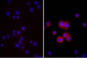 Human pancreatic carcinoma cell line MIA PaCa-2 was stained with Mouse Anti-Human CD44-UNLB, and DAPI. (Âne anti-Souris IgG (Heavy & Light Chain) Anticorps (FITC) - Preadsorbed)