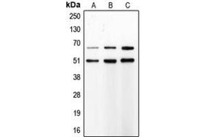 Western blot analysis of MMP8 expression in SJRH30 (A), PMNL (B), Sw620 (C) whole cell lysates.